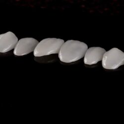 Licówki zębów Licówki zębów Opole