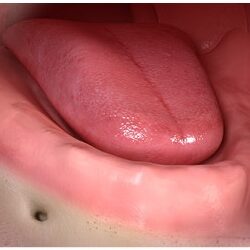 Implanty Opole Proteza zębowa na implantach Opole