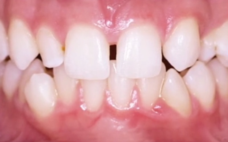 Ortodonta - Ortodoncja Opole Ortodonta - Ortodoncja Opole