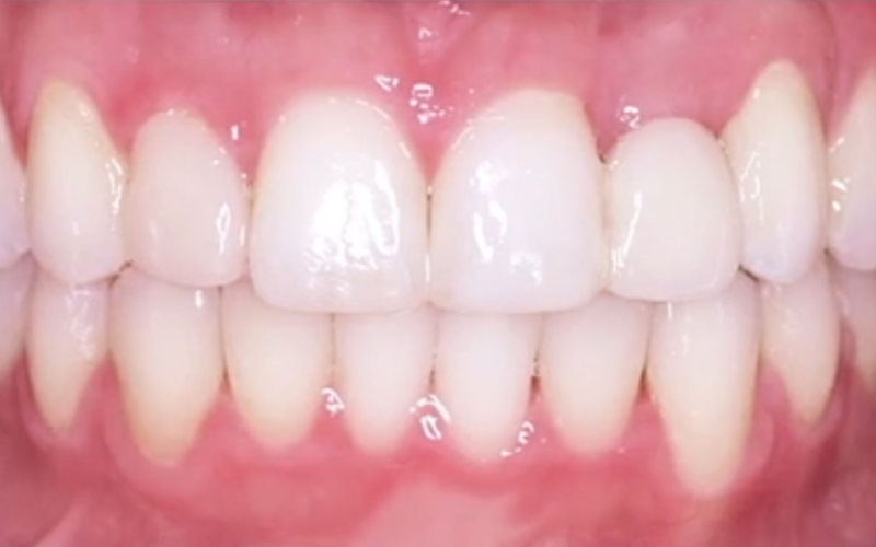 Ortodonta - Ortodoncja Opole Ortodonta - Ortodoncja Opole