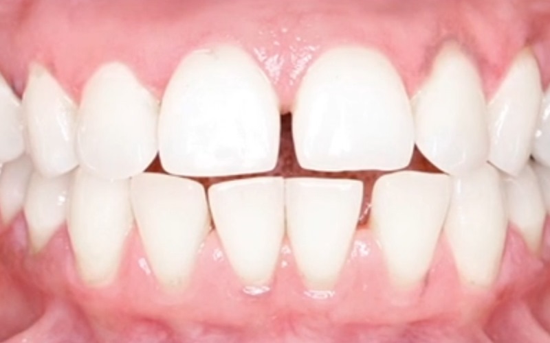 Ortodonta - Ortodoncja Opole Ortodonta - Ortodoncja Opole