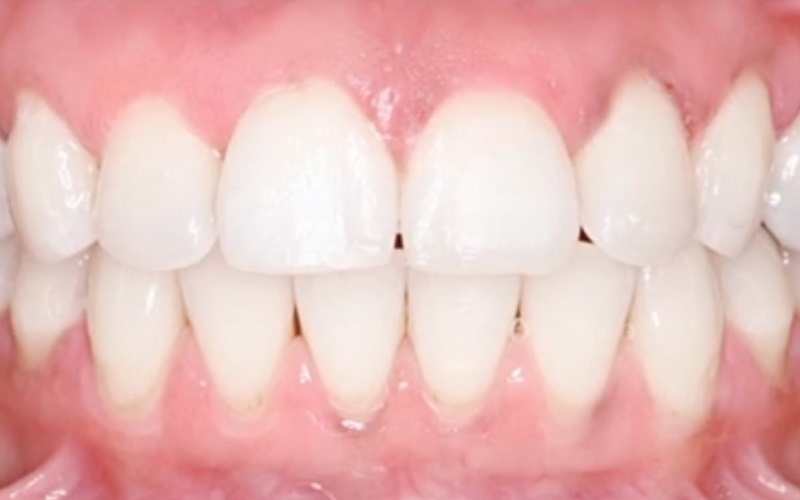 Ortodonta - Ortodoncja Opole Ortodonta - Ortodoncja Opole