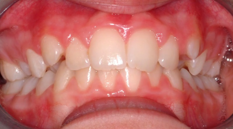 Ortodonta - Ortodoncja Opole Ortodonta - Ortodoncja Opole