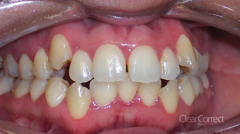 Ortodonta - Ortodoncja Opole Ortodonta - Ortodoncja Opole