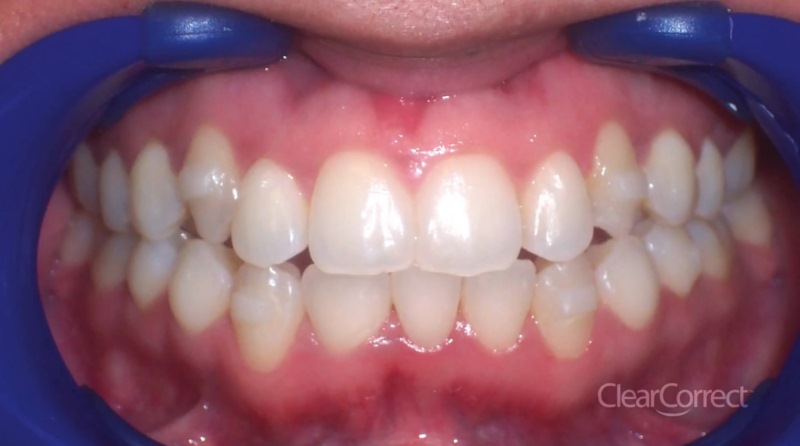 Ortodonta - Ortodoncja Opole Ortodonta - Ortodoncja Opole