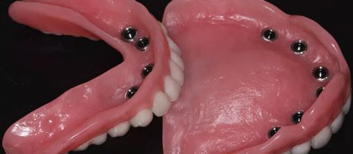 protezy zębów opole